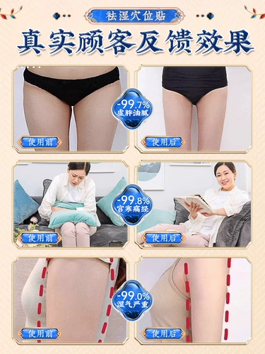 Удаление подсолнечника и детоксикация сырости и детоксикации мокрой, холодной талии и точки иглоукалывания, сырости и осушивания пупок кнопки