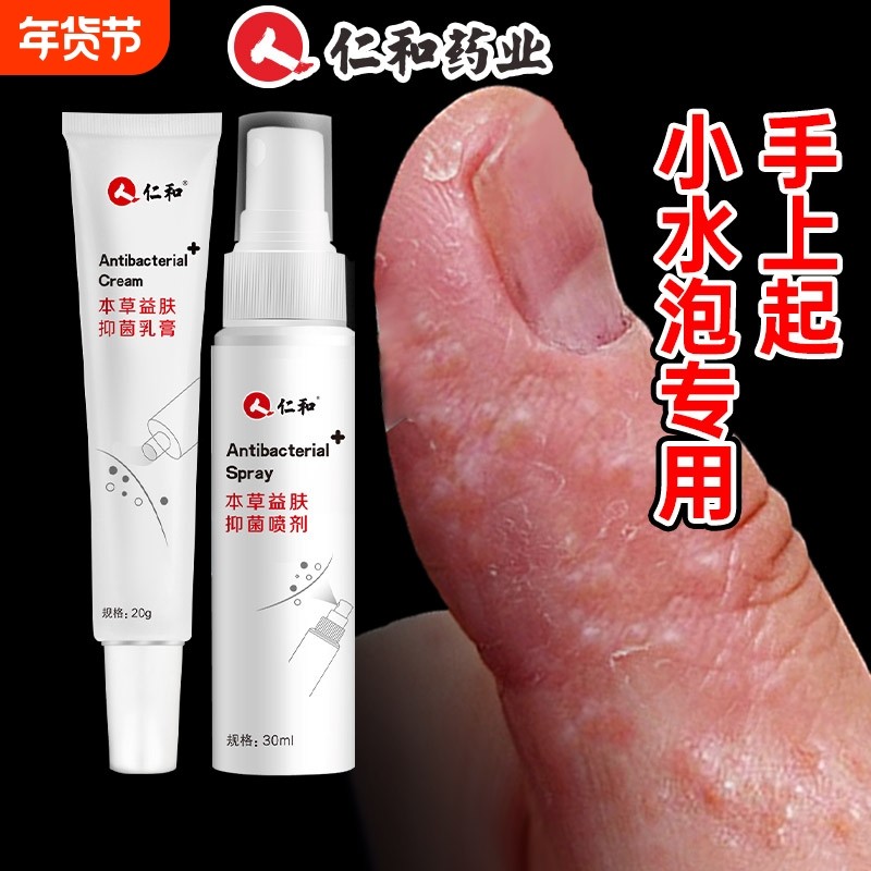 手上起小水泡手痒指长非汗状疱疹专用软膏止痒汗包膏汗泡膏汗孢疹,保健用品,皮肤消毒护理（消）,淘宝优惠券,粉丝福利购,淘宝优惠卷