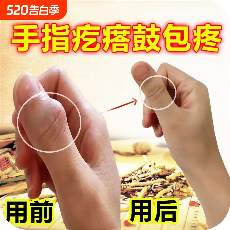 手指骨节粗大变形关节疙瘩鼓包肿大消肿疼痛专用活络