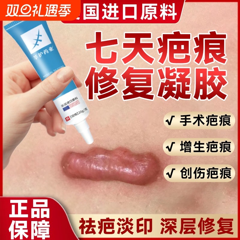 祛疤膏疤克去疤痕修复无痕除疤膏第一名医用巴克官方正品旗舰店
