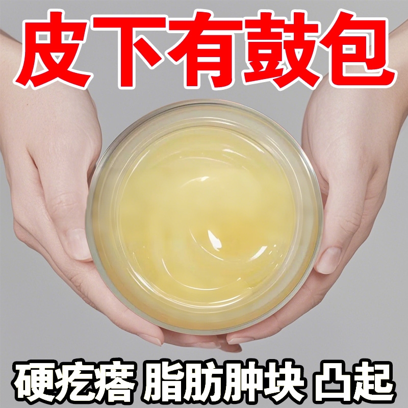 【拒绝鼓包】香港脂肪瘤肿块霜脂肪灵皮下硬块单发多发性涂草本抹