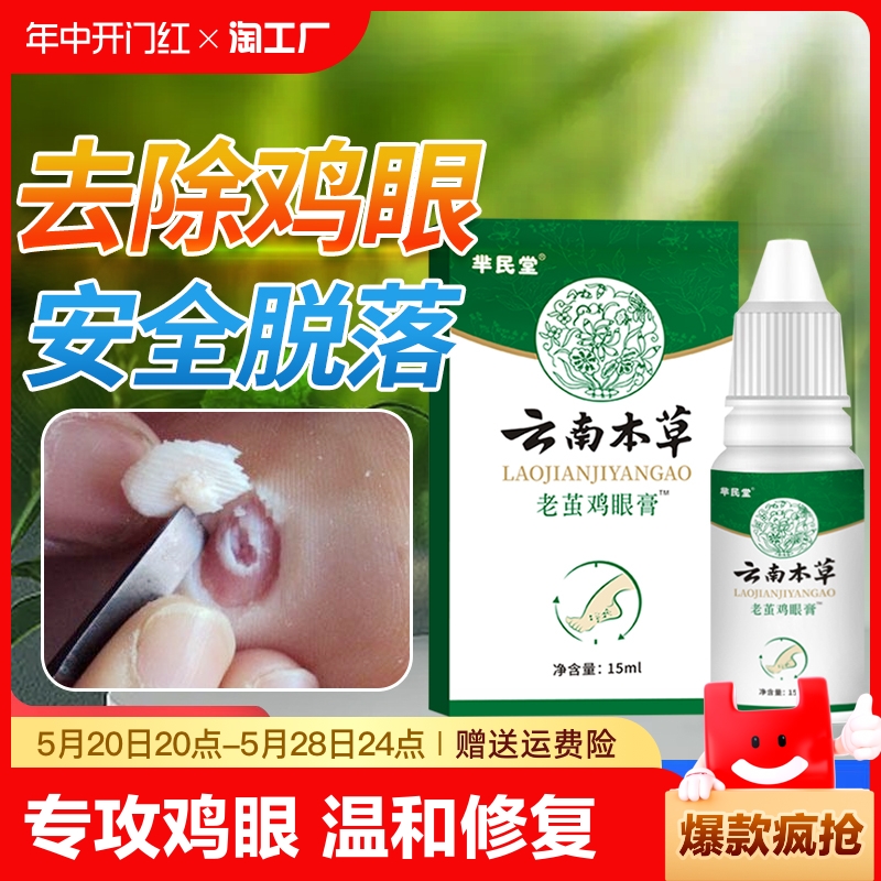 云南本草老茧鸡眼膏贴正品去脚底肉刺鸡眼贴鸡眼膏成膜去除液抑菌