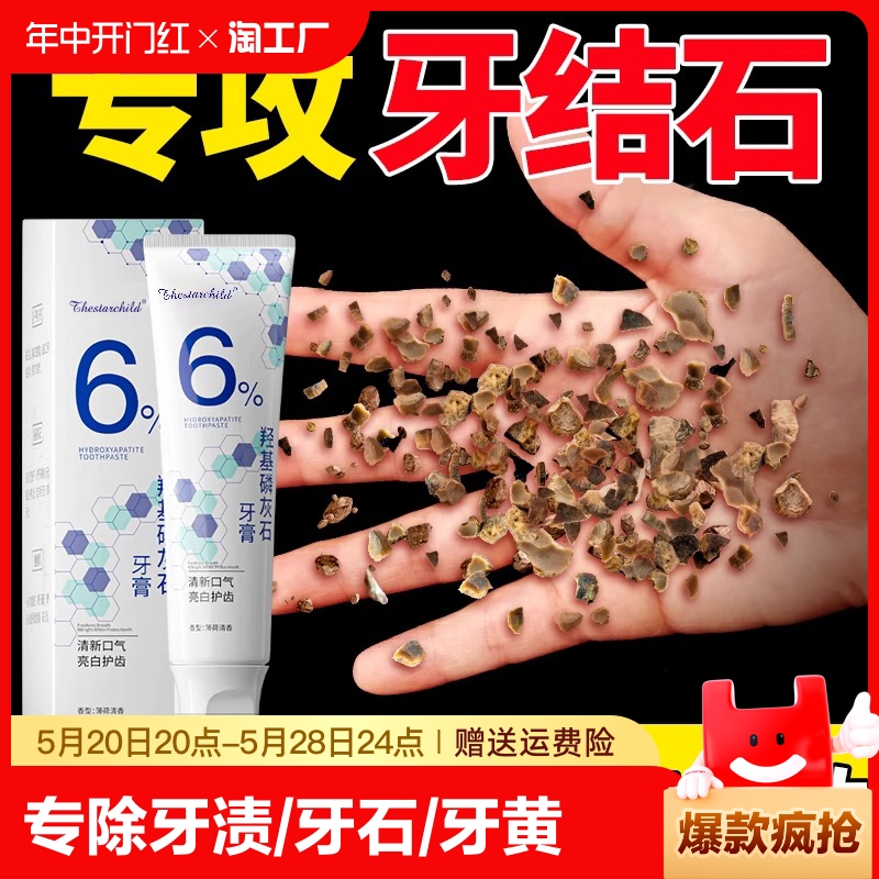 牙科专研羟基磷石灰去牙石牙膏