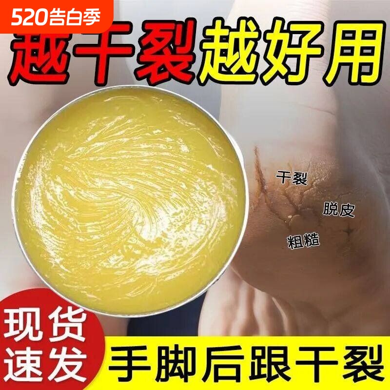 香港脚后跟干裂修复霜手足龟裂开裂治起皮去死皮润马油皱裂膏