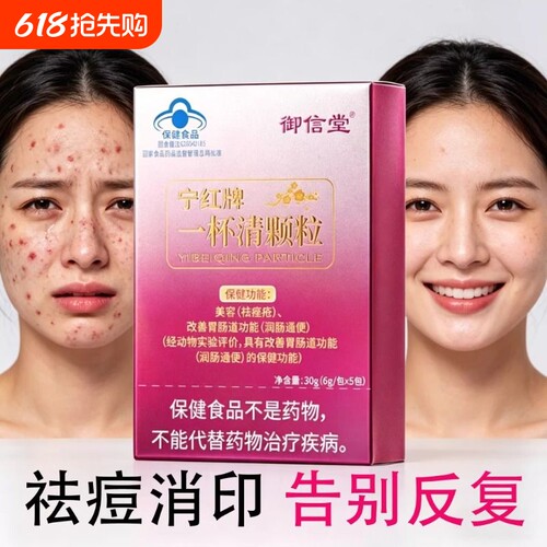 御信堂一杯清颗粒痘痘痤疮青春痘改善肠胃功能男女通用