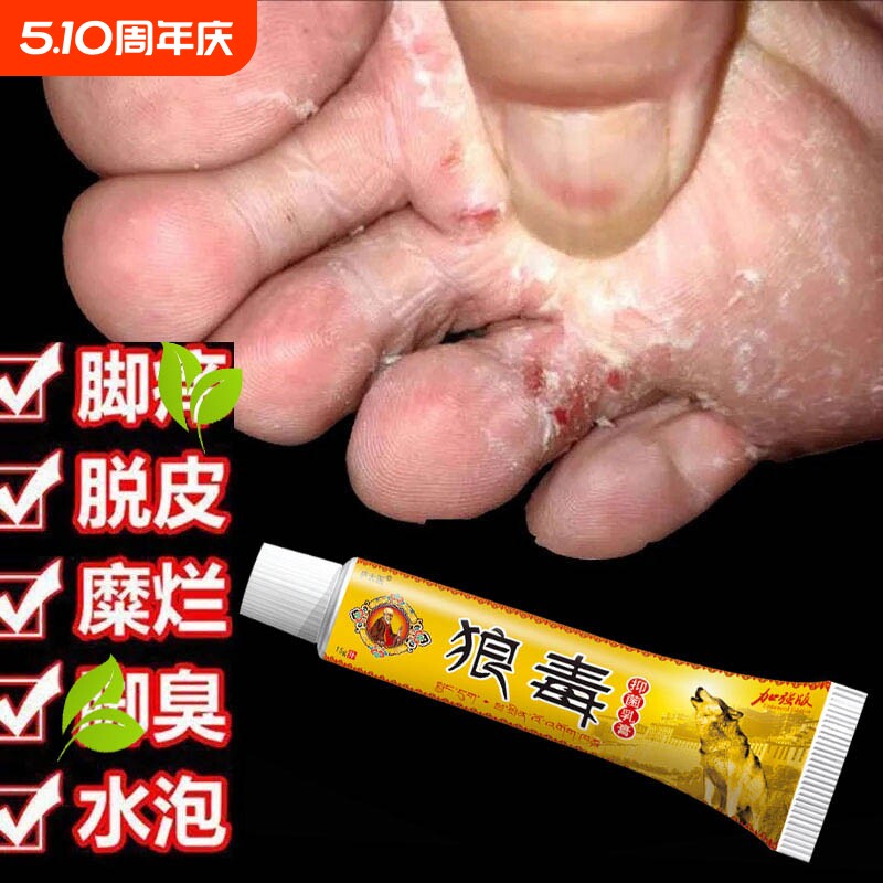 狼毒软膏正品抑菌奇草乳膏去气脚专用水泡皮肤止痒膏脚丫子痒烂脚