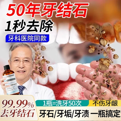 牙石溶解漱口水杀菌除口臭持久留香洗牙齿污垢牙垢黄牙渍清理神器