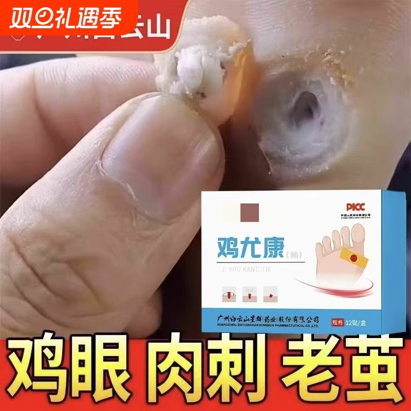 鸡眼贴去鸡眼神器老茧鸡贴眼脚钉祛除膏鸡茧眼足部鸡贴眼膏正品
