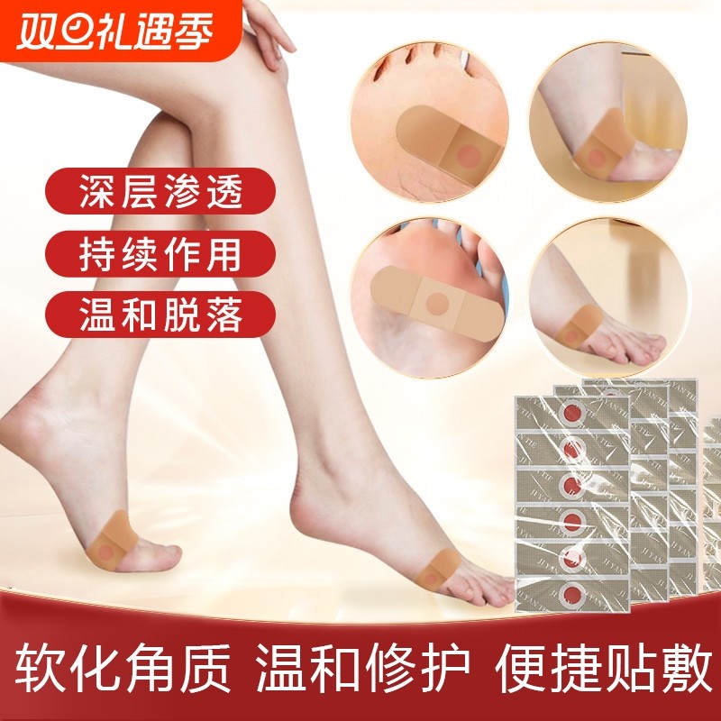 鸡眼贴去鸡眼老茧死皮肉刺跖疣瘊子脚茧鸡尤康贴手足部棉签小巧