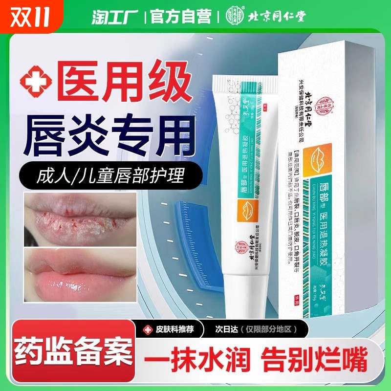 鸡眼贴手部足部专用正品