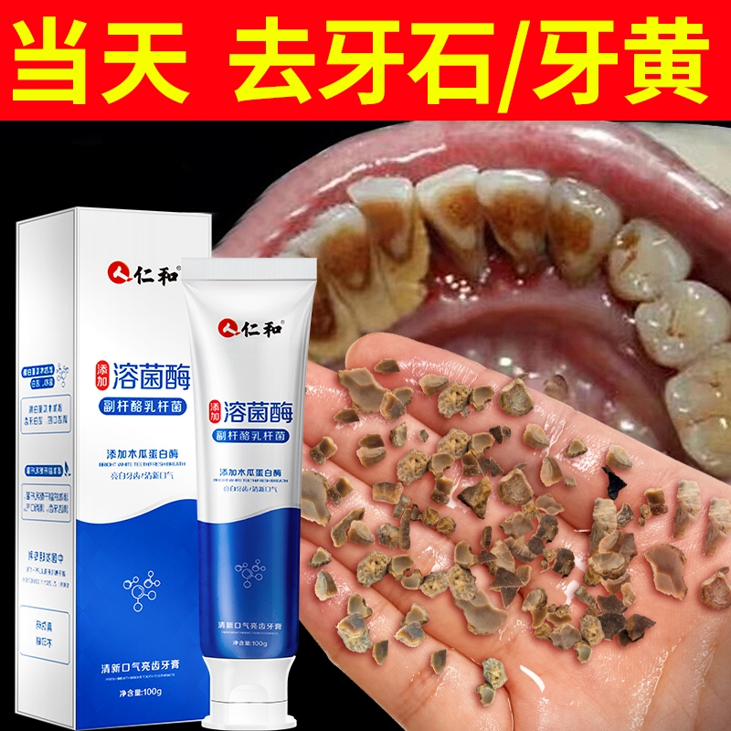酵素牙膏美白去黄口臭牙结石成人亮白神器官方正品牙结石神器