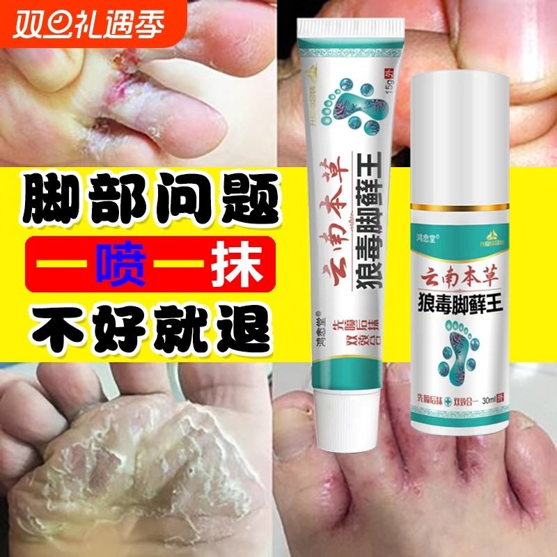 云南本草狼毒脚藓王脚气脚痒脚臭脱皮水泡烂脚丫糜烂脚趾止痒乳膏