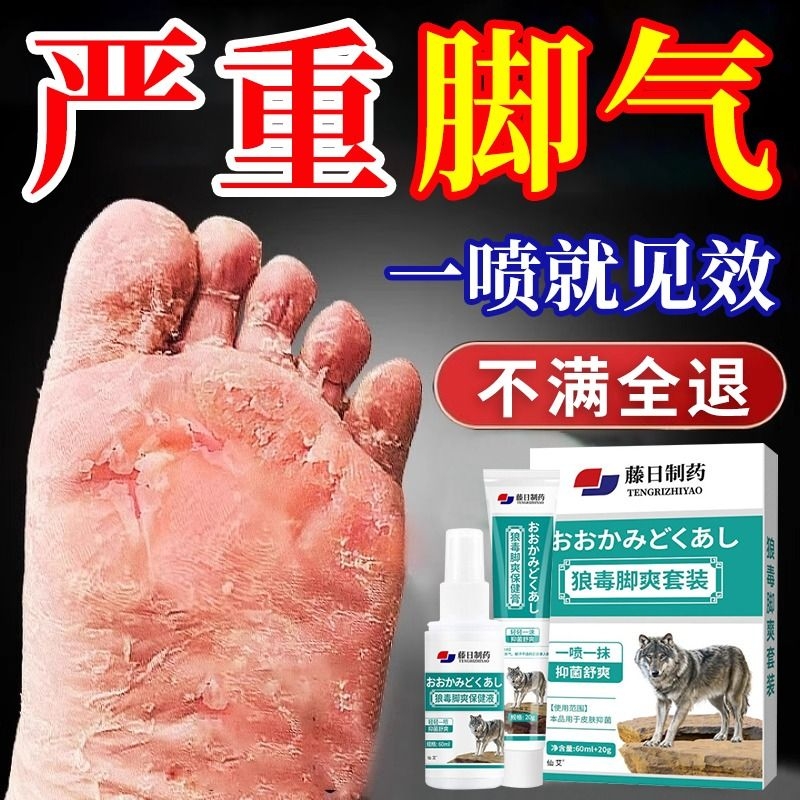 【热销100w+】三甲同款脚气喷雾