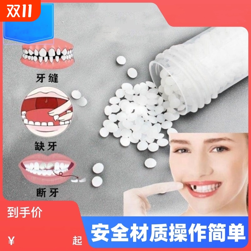 树脂材料牙齿自己洞假牙套补永久牙神器填充膏在家牙缝正品临时