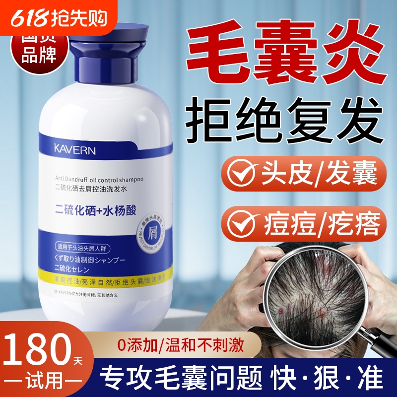 500ml 1ƿ500ml Чװ ȥмֹ 滺 ëϴˮȥмֹͷƤϴͷ¶ŮٷƷ31.53Ԫ