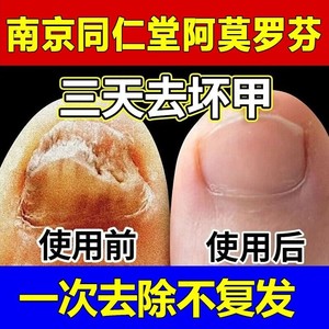 阿莫罗芬搽剂灰指甲专用正品旗舰店修复脱甲膏真菌感染抑菌液灰甲