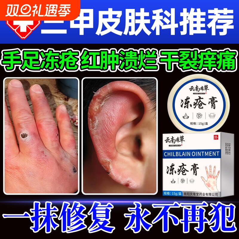 云南本草冻疮膏止痒冻伤膏正品官方旗舰店防冻裂手足冻耳朵伤消肿