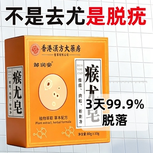 香皂去祛脖子上长尤瘊小肉粒疙瘩克除丝状尤药皂手工洗澡专用膏BA