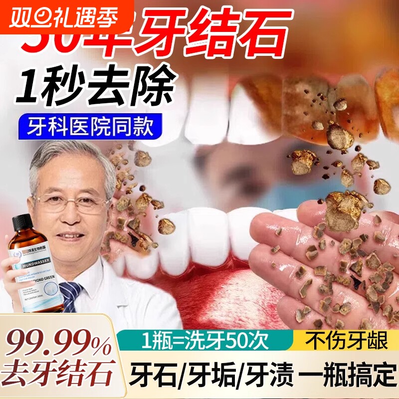 牙石溶解漱口水杀菌除口臭持久留香洗牙齿污垢牙垢黄牙渍清理神器