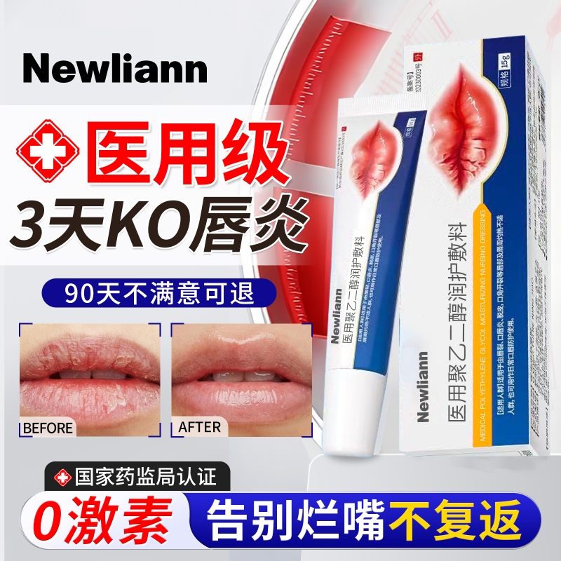 唇炎唇膏嘴唇干裂脱皮医用型儿童嘴角开裂专用润膏保湿滋润补水