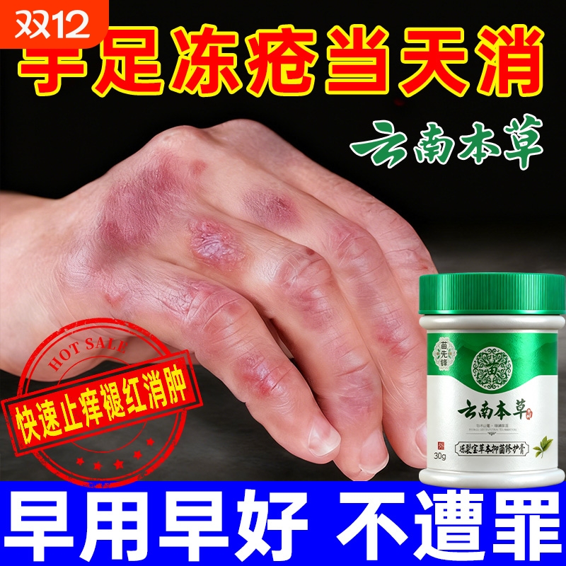 云南本草冻疮膏止痒冻伤膏防裂膏冻手足儿童耳朵正品官方旗舰店