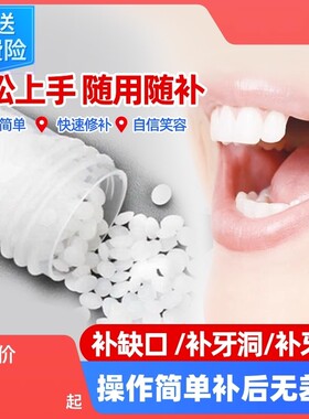 树脂材料牙齿自己洞假牙套补永久牙神器填充膏在家牙缝正品临时