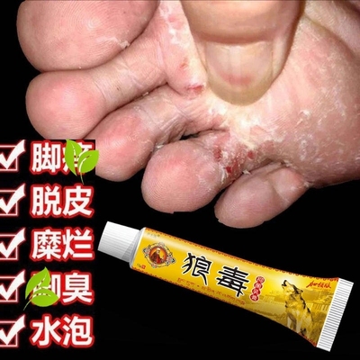 狼毒软膏正品抑菌奇草乳膏去气脚专用水泡皮肤止痒膏脚丫子痒烂脚