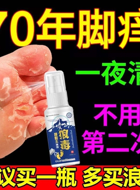 狼毒喷脚王喷雾剂水泡型脱皮感染专用止痒臭脚软膏真菌非杀菌正品