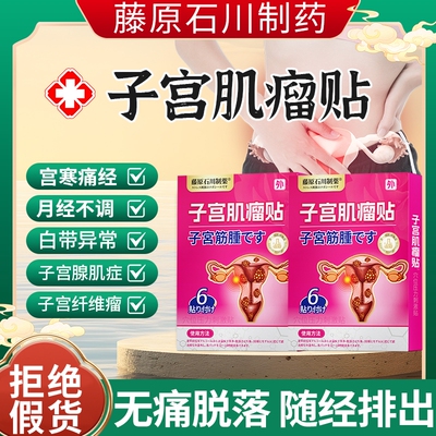 子宫肌瘤中药贴治疗巧克力卵巢囊肿宫颈内膜息肉腺肌症调理热敷贴