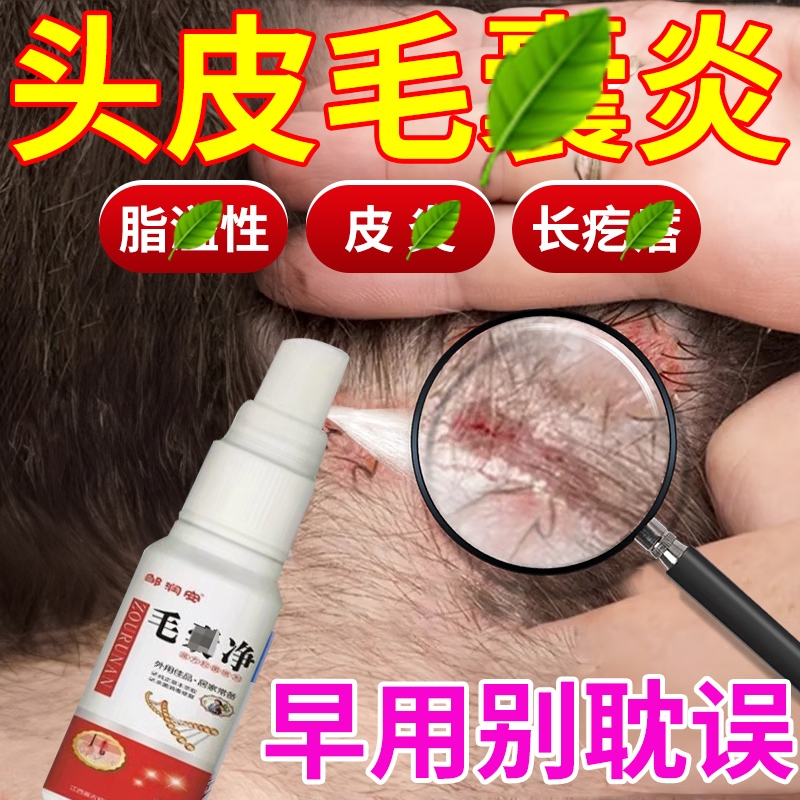 邹润安毛囊净抑菌|209人收藏