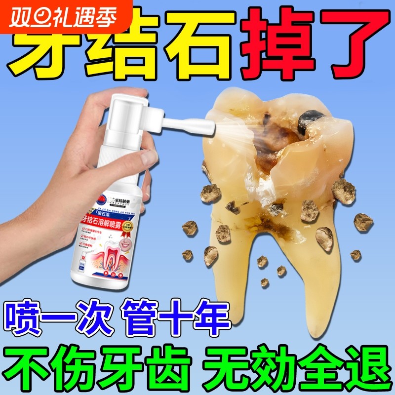 牙结石去除溶解除牙石非漱口水洗牙齿污垢牙黄牙垢牙渍牙龈口腔