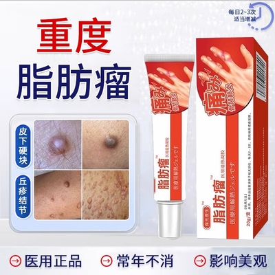 【脂肪瘤去除神器】第一名