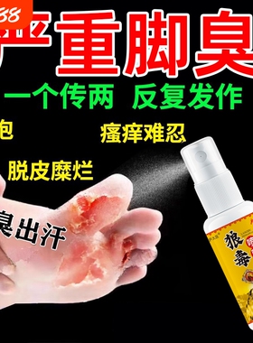 狼毒喷脚王正品脚汗足部专用抑菌软膏草本舒足脚爽脚丫清喷雾剂
