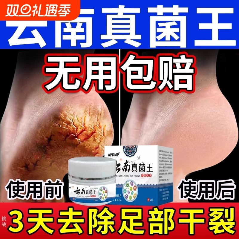 脚后跟干裂修复霜手足开裂皲裂治起皮去死皮润马油皱裂膏保湿滋润
