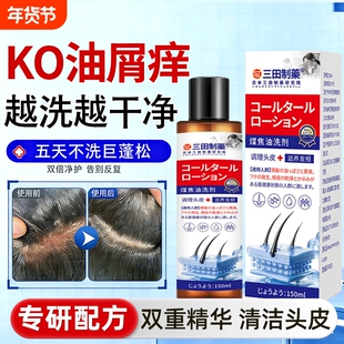 煤焦油洗剂脂溢性皮炎去屑洗发止痒水医用官方旗舰店正品