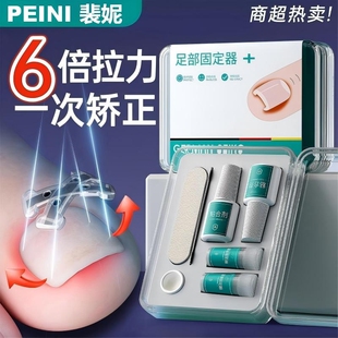 甲沟专用矫正器嵌甲纠贴片修脚趾甲剪刀指甲钳不再往肉里长炎神器