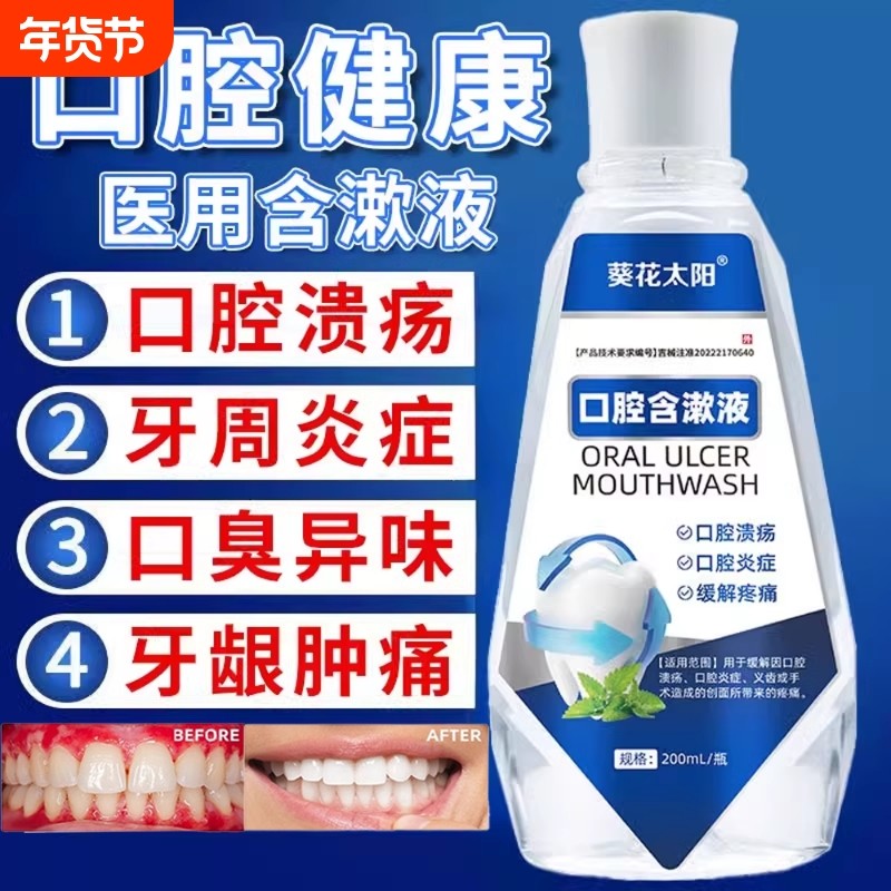 医用漱口水杀菌消炎牙周炎除口臭持久留香溶解口腔溃疡出血抗菌,医疗器械,牙齿防龋/脱敏类,淘宝优惠券,粉丝福利购,淘宝优惠卷
