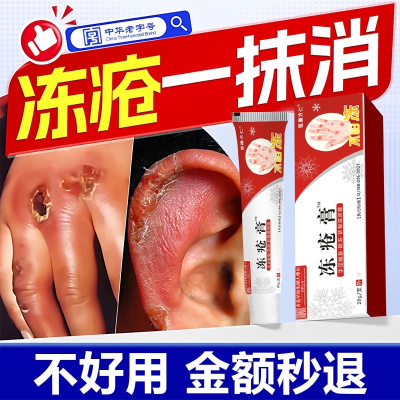 冻疮膏止痒冻伤膏正品防冻排行榜第一名官方旗舰店儿童耳朵手冻伤