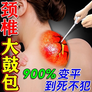 已售100万富贵包消除贴脖子颈部鼓包疼痛颈椎病专用久坐中药肩颈