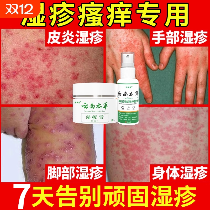 云南本草去顽固湿疹专用套装