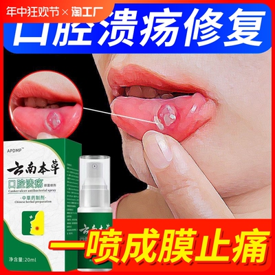 云南本草口腔溃疡专用修复液喷剂