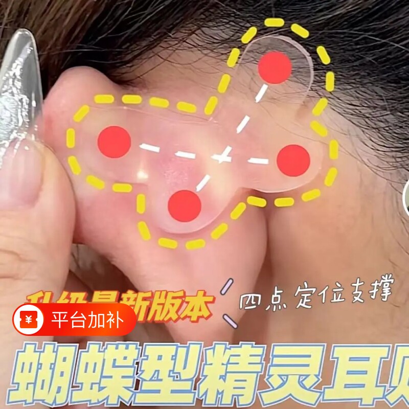 蝴蝶型精灵耳贴强支撑定型立耳神器显小证件照隐形撑耳直播用贴面