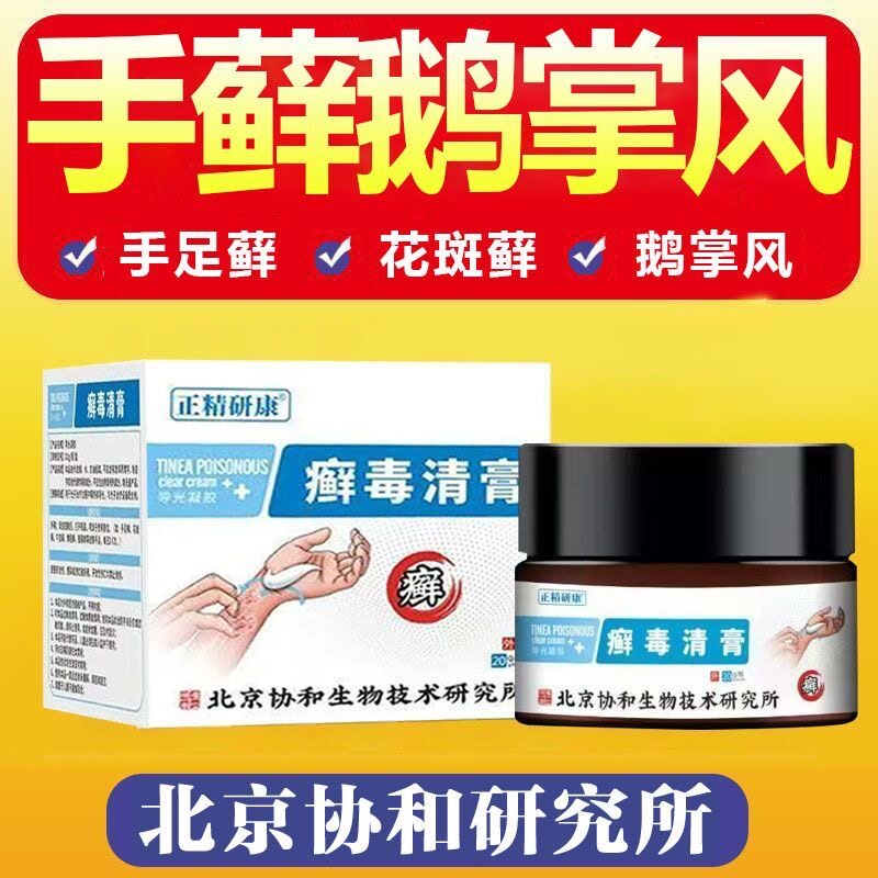 鹅掌风手癣专治皮肤癣痒汗孢疹牛皮外用止痒抑菌湿毒药膏手足脱皮