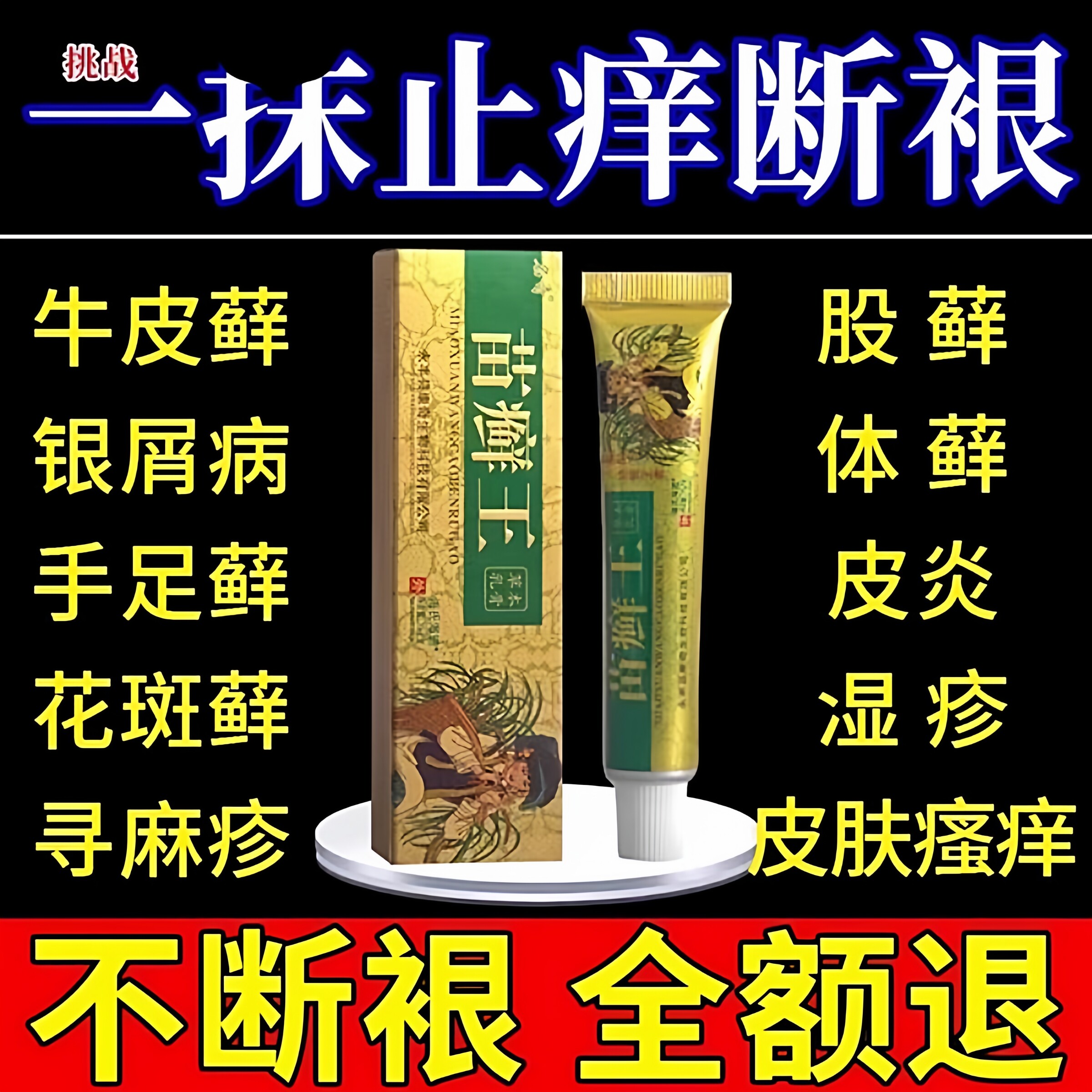 苗癣王专治皮肤癣痒苗家医用特藓湿疹去止痒根外用顽固皮炎效药膏