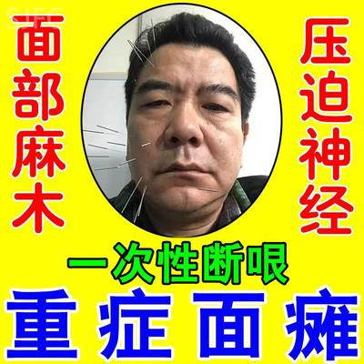 面瘫特效药膏贴脸部训练