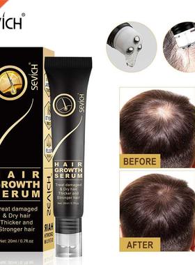 Sevich Hair Growth Oil Ginger Extract Growing Serum Prevent