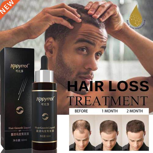 Hair Loss Treatment Hair/Beard Growth Oil Hair Care Product