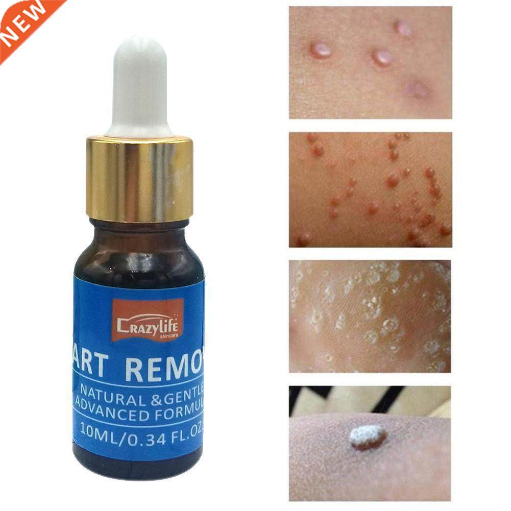 10ML Body Wart Treatment Papillomas Removal of Warts Liquid