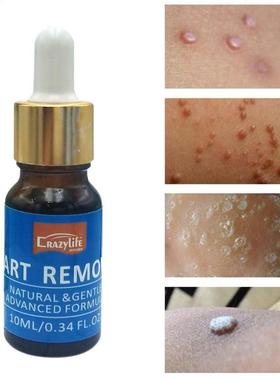 10ML Body Wart Treatment Papillomas Removal of Warts Liquid