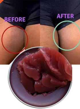 20ML Inner Thigh Whitening Cream, Spotless Inner Thigh, Spot